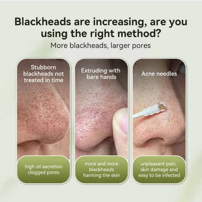 Lumé™ Blackhead Peel-Off Masker
