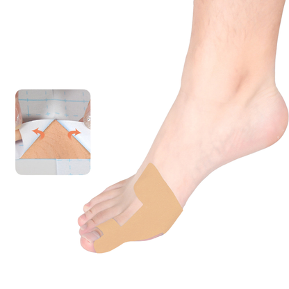 Teencorrector Bandage Set – Teenuitlijning Steun