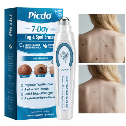 Verfijnende Roller-Serum – Voor een Heldere Huid